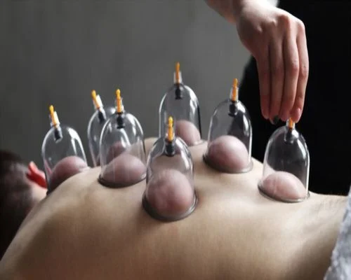 best cupping service